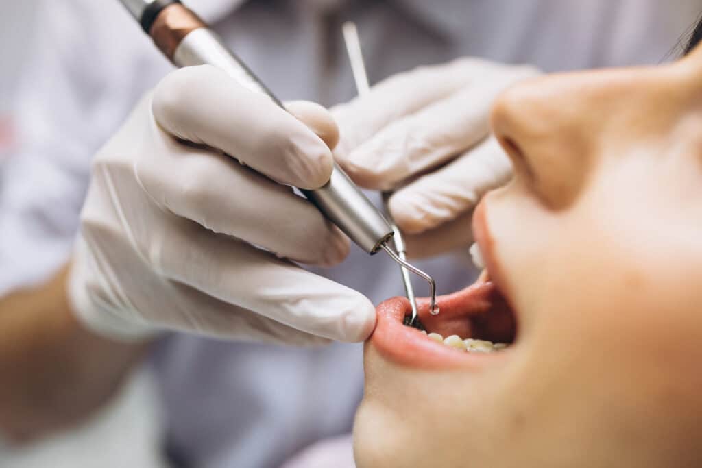 tooth extraction