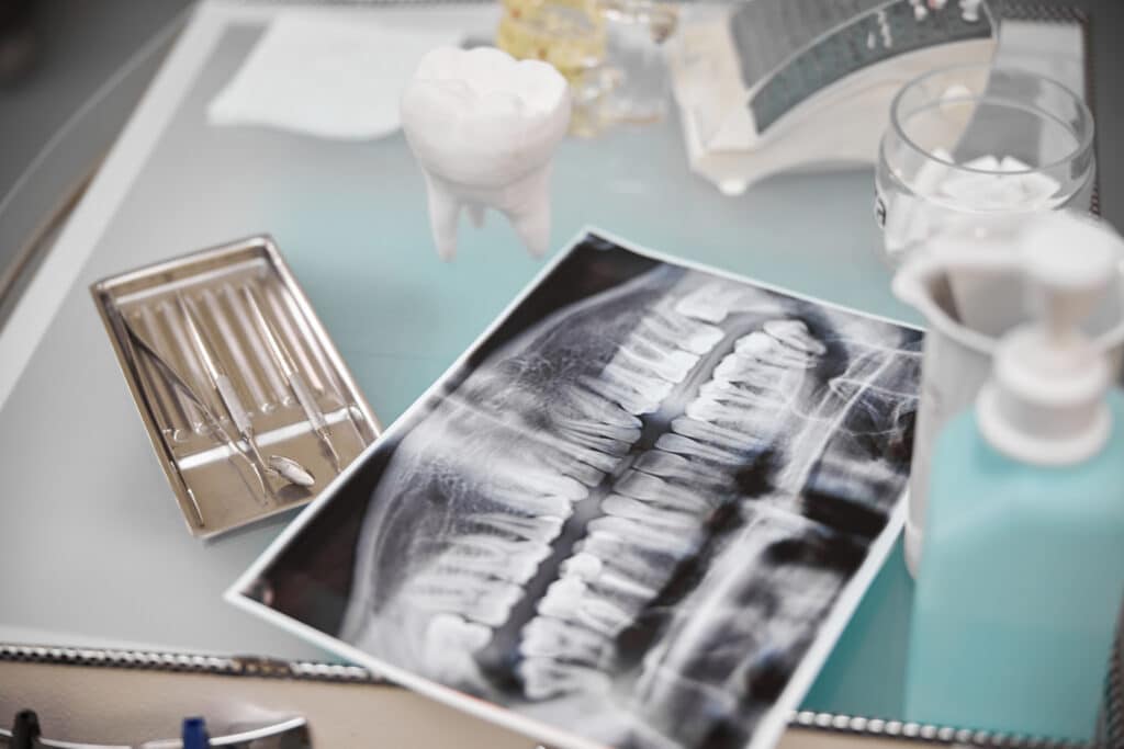 Oral Cancer & Pathology